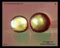 klebsiella pneumoniae and e.coli colony on Endo agar in detail